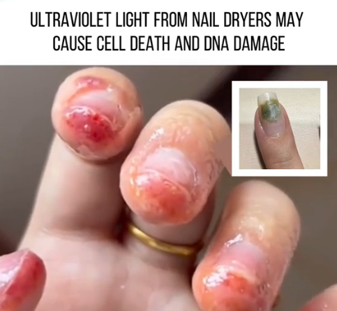 Shocking Study Reveals UV Nail Dryers Could Be Slowly Destroying Your Hands — Causing DNA Damage and Cell Death!