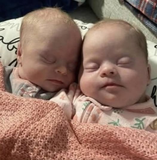 Twin mom with Down syndrome children shuts down online haters.