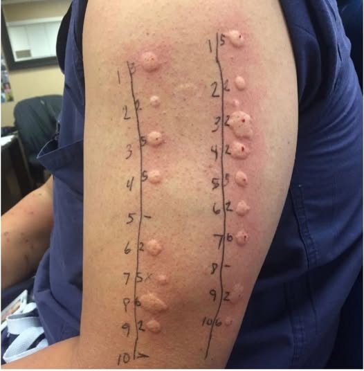 HT2. These are the consequences of sleeping with the… See more