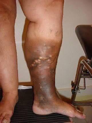 These are the consequences of sleeping with…See more