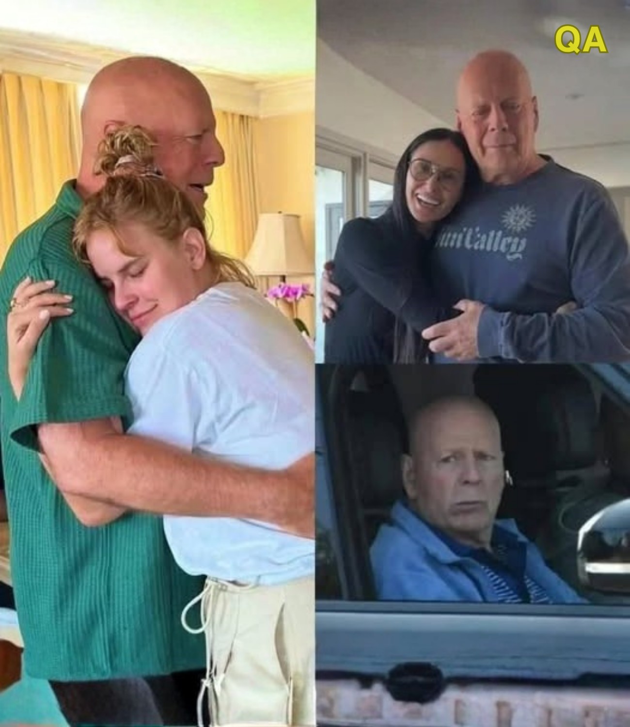 SB. Bruce Willis Health Update: Living with Frontotemporal Dementia and the Power of Family Support