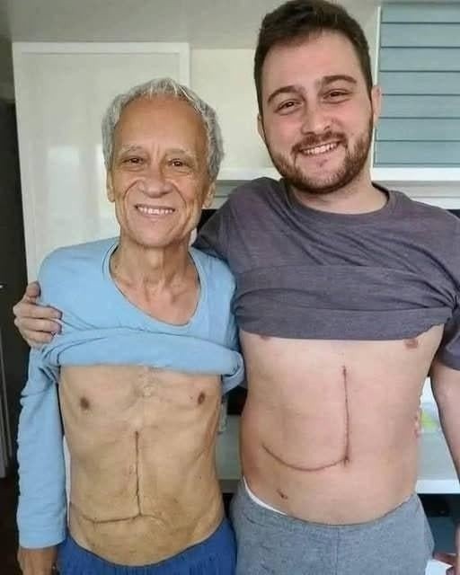 Son who donated part of his liver to his father unfortunately ends up fa… See more