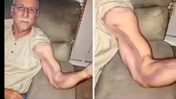A man goes to stretch and ends up feeling a sharp pain in his arm, it was a ca…
