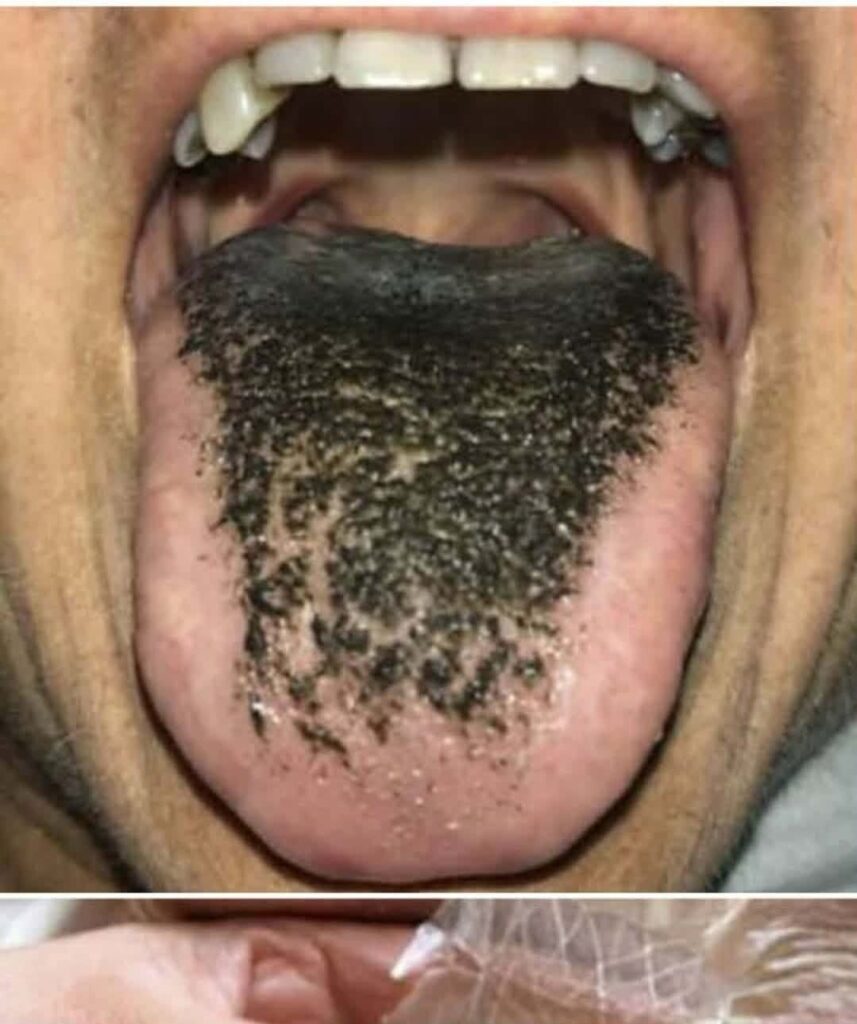 These are the consequences of sleeping with the… See more
