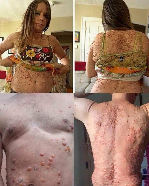 Understanding Skin Changes, Bumps, and Irritations in Sensitive Areas: Causes, Care, and When to Consult a Professional